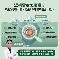 近視雷射怎麼選？比起術式，更重要的是「你的眼睛適合什麼」!