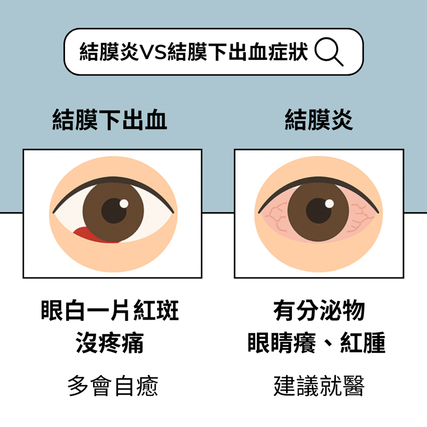 結膜炎VS結膜下出血症狀