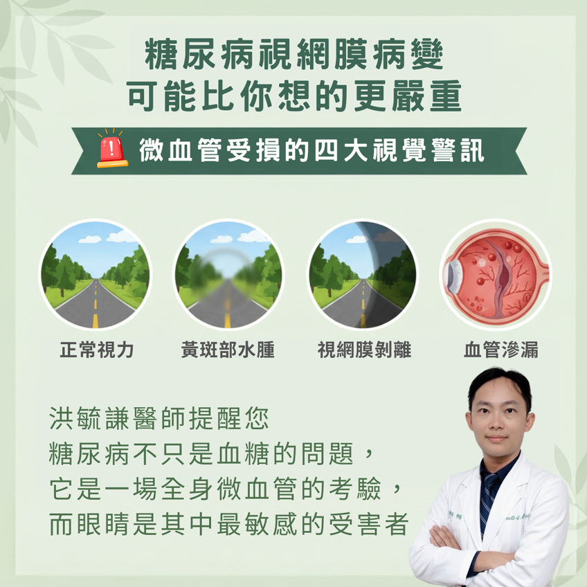 糖尿病視網膜病變,可能比你想的更嚴重:維血管受損的四大視覺警訊 糖尿病視網膜病變,可能比你想的更嚴重:維血管受損的四大視覺警訊