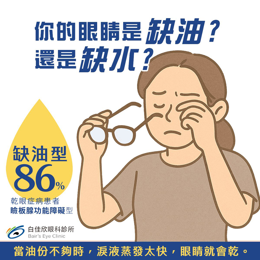 你的眼睛是缺油？ 還是缺水？