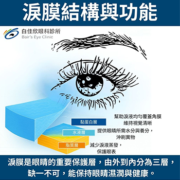 眼睛乾、澀、刺痛？你可能是「乾眼症」! 醫師帶你認識成因、症狀與對策