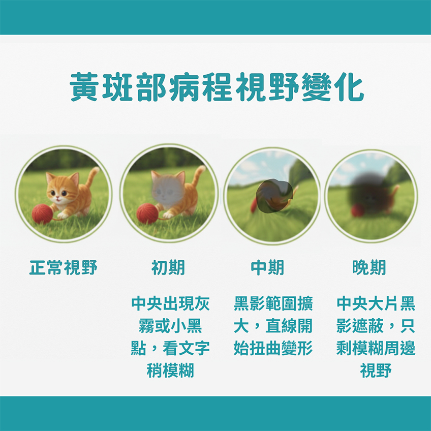 黃斑部病程視野變化