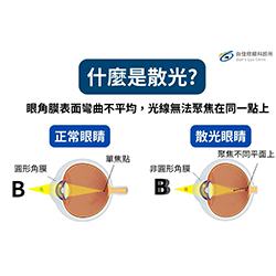 散光是什麼？症狀、成因與最新矯正方法完整解析
