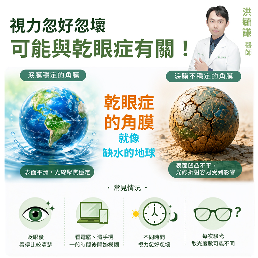 散光度數忽高忽低，居然可能跟乾眼症有關？！