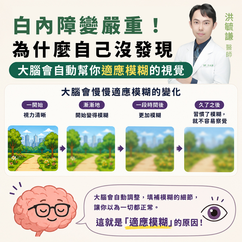 視力感覺和之前差不多，但檢查後白內障變嚴重了？