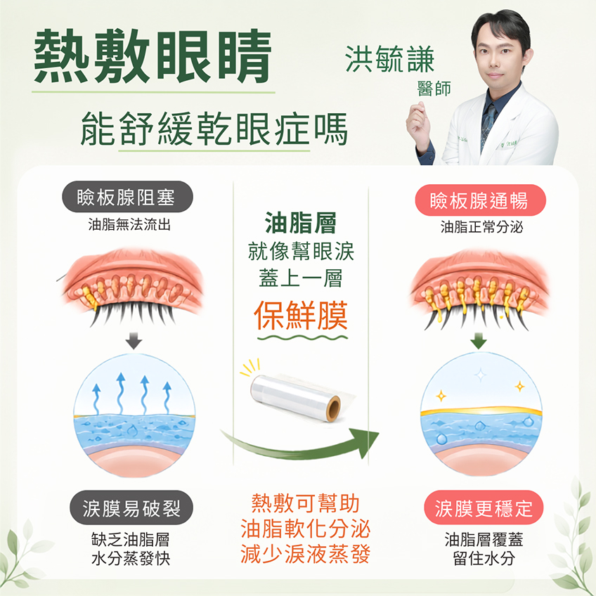 熱敷眼睛，真的可以改善乾眼症嗎？