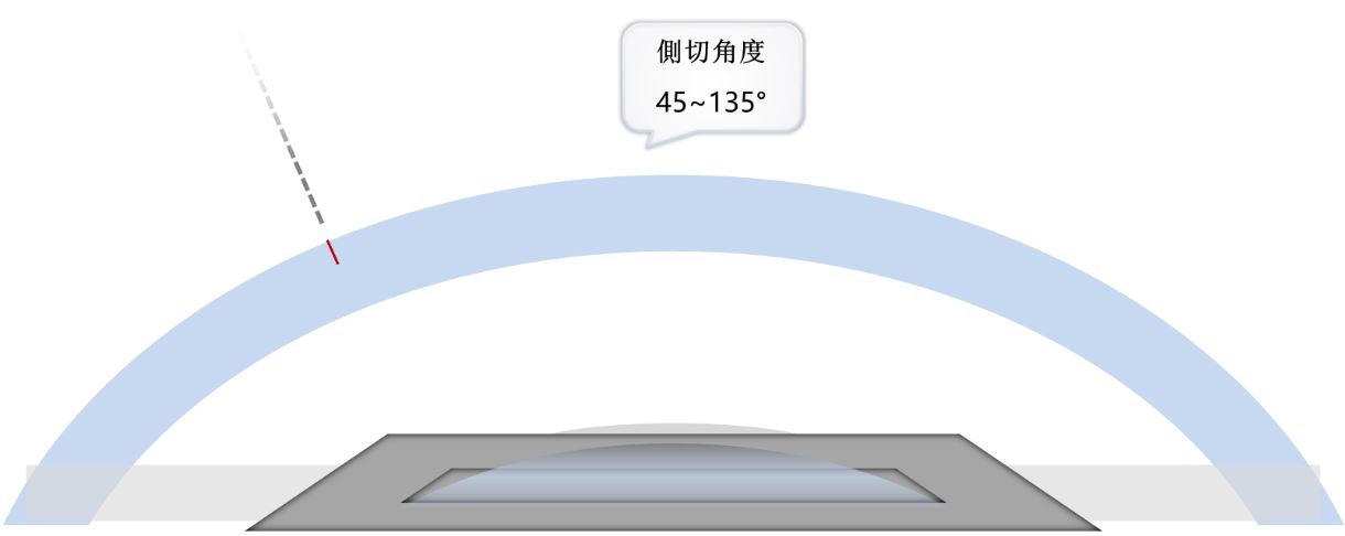 ReLEX飛秒雷射: 1.弧形低壓角膜負壓環，符合角膜弧度，不壓迫角膜，大幅降低術後結膜下出血的情況