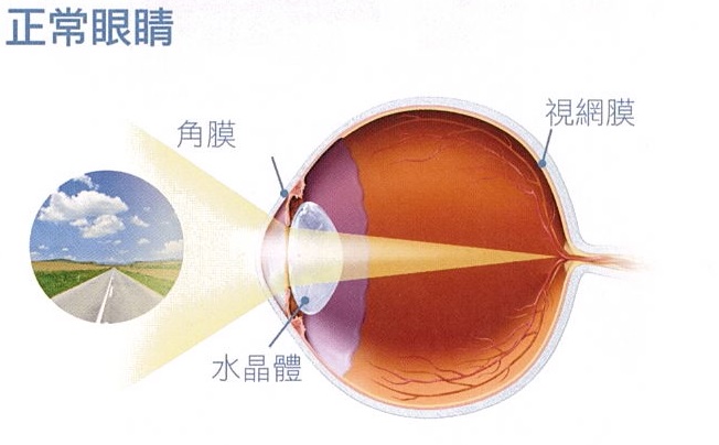 正常眼睛 正常眼睛