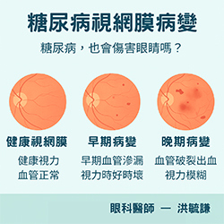 警惕！別讓高血糖悄悄偷走你的視力