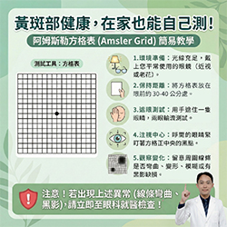 如何自我檢測黃斑部病變？簡單的阿姆斯勒方格表測試