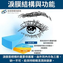 眼睛乾、澀、刺痛？你可能是「乾眼症」! 醫師帶你認識成因、症狀與對策