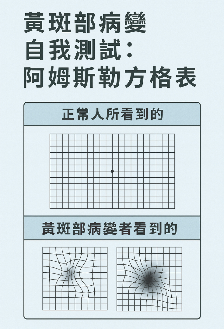 黃斑部病變自我測試:阿姆斯勒方格表 黃斑部病變自我測試:阿姆斯勒方格表