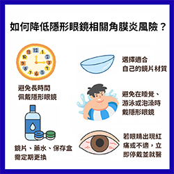 別讓習慣傷了角膜！隱形眼鏡族的角膜炎風險、症狀與專業治療全解析