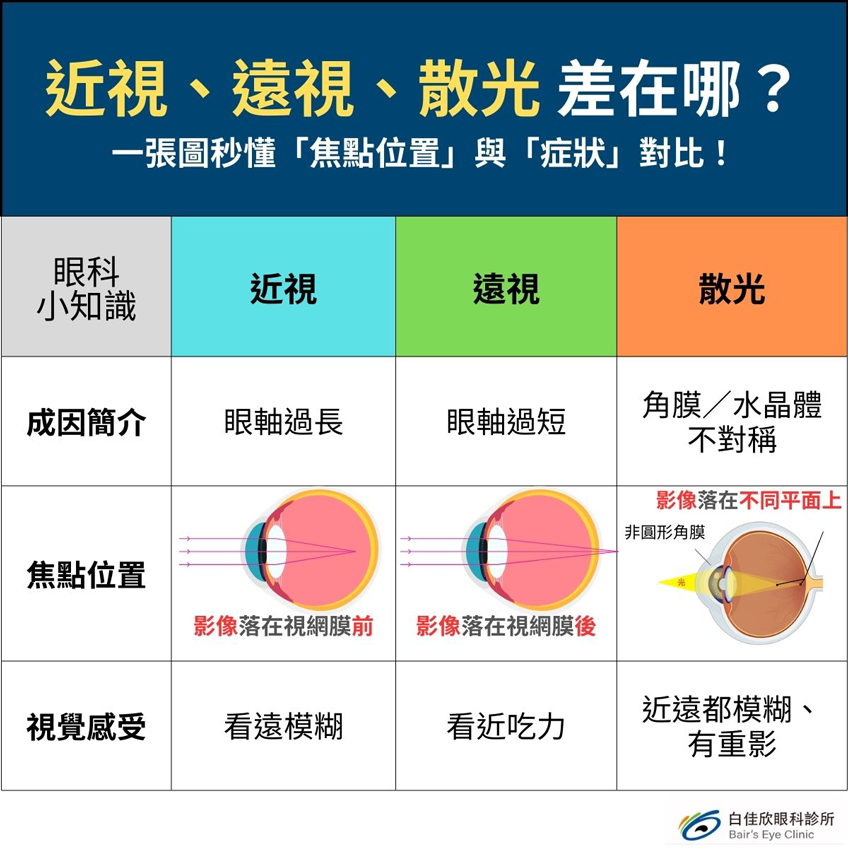 近視、遠視、散光差在哪？