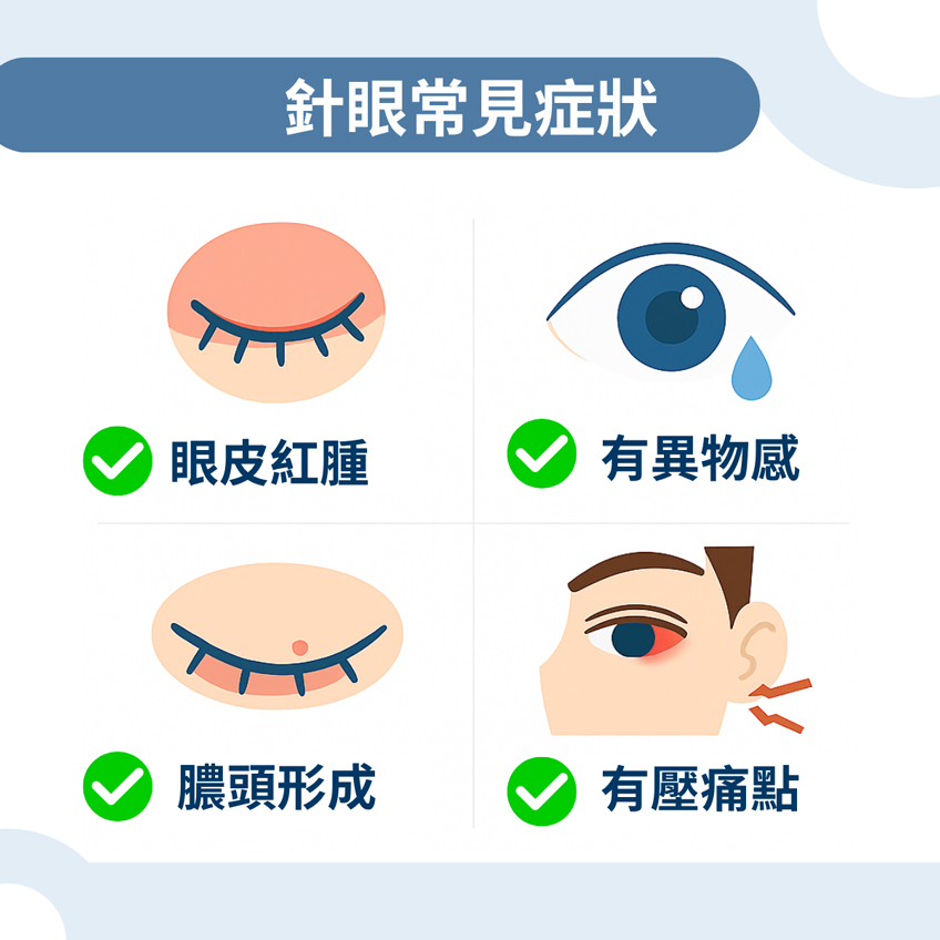 針眼常見症狀 針眼常見症狀