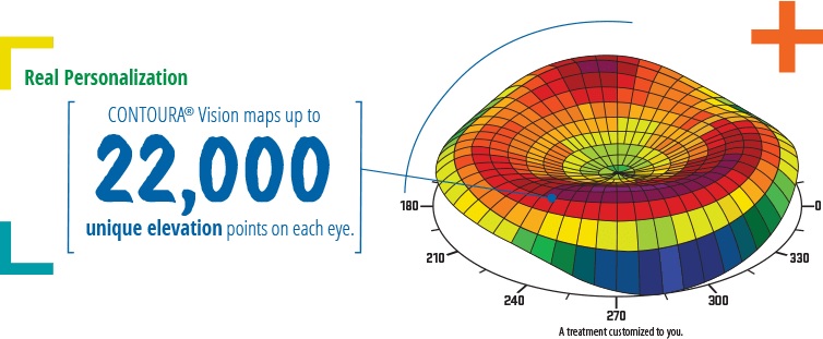 Contoura Vision角膜地圖引導精雕LASIK