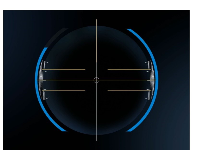 SMILE PRO全飛秒近視雷射手術：使用雷射中心定位術中導引及虹膜辨識與記號追蹤定位，減少術中定位時間且更精準。