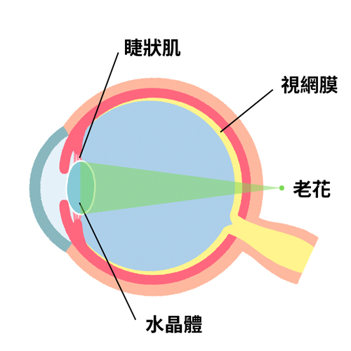 老花眼的徵兆